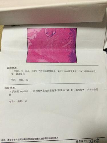 leep刀锥切宫颈视频,leep刀锥切宫颈手术过程详解